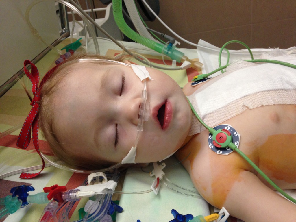 Baby Valeria after surgery